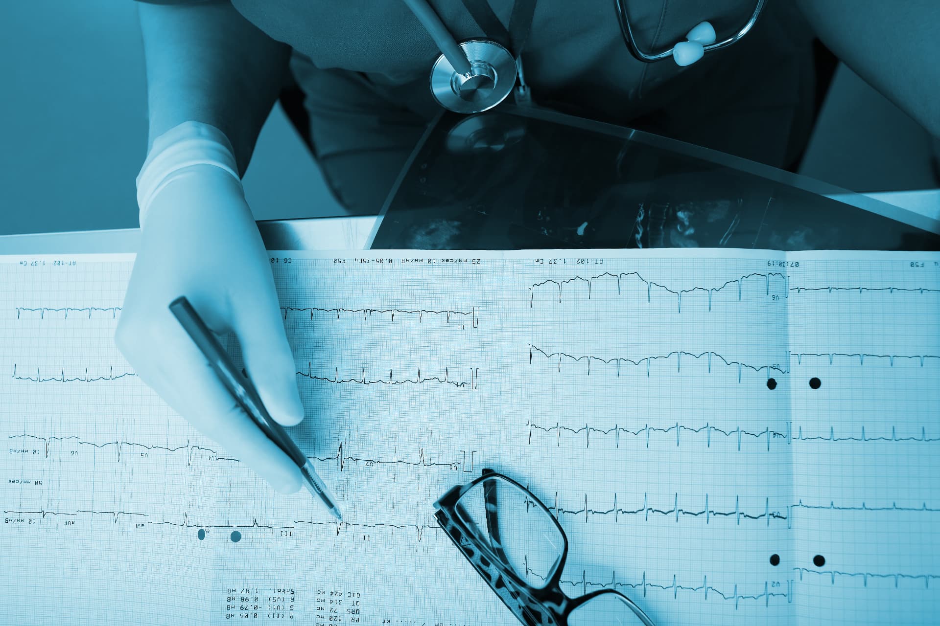 Electrophysiology lab for heart rhythm procedures at Pulse Healthcare System